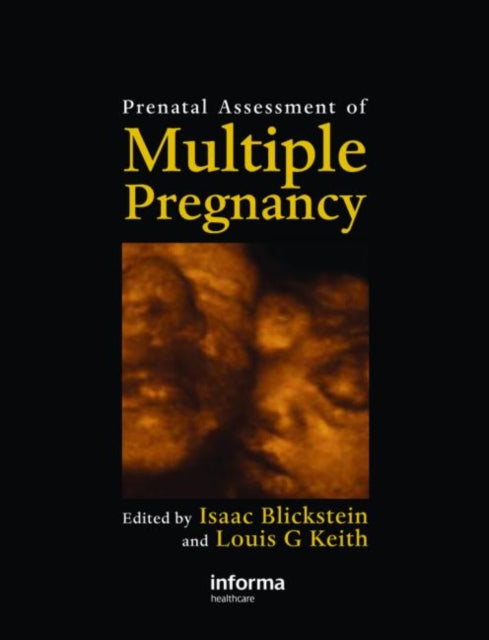 Book cover of: Prenatal Assessment of Multiple Pregnancy