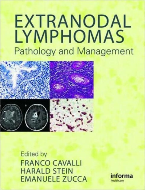 Extranodal Lymphomas