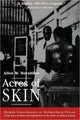 Book cover of: Acres of Skin. By: Allen Hornblum