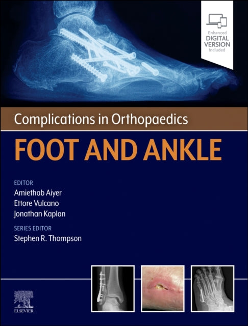 Book cover of: Complications in Orthopaedics: Foot and Ankle. By: Amiethab Aiyer