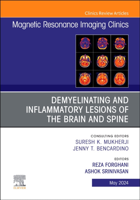 Book cover of: Demyelinating and Inflammatory Lesions of the Brain and Spine, An Issue of Magnetic Resonance Imaging Clinics of North America. By: Reza Forghani