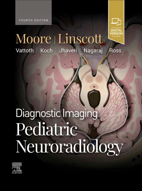 Book cover of: Diagnostic Imaging: Pediatric Neuroradiology. By: Kevin R. Moore
