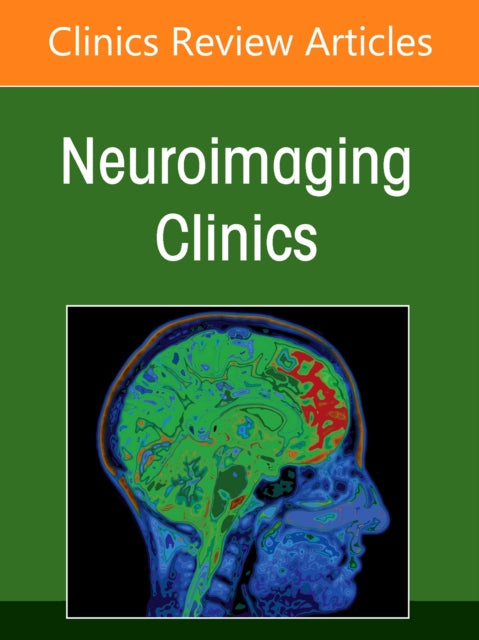 Book cover of: Management and Treatment of Cerebral Aneurysms, An Issue of Neuroimaging Clinics of North America