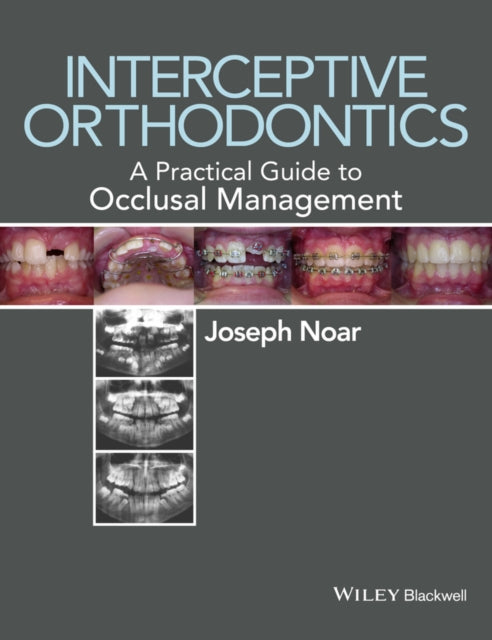 Book cover of: Interceptive Orthodontics. By: Joseph Noar