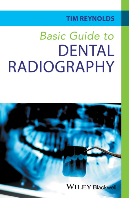 Book cover of: Basic Guide to Dental Radiography. By: Tim Reynolds
