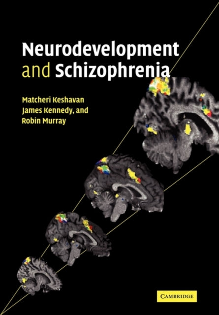Book cover of: Neurodevelopment and Schizophrenia. By: Matcheri S. Keshavan