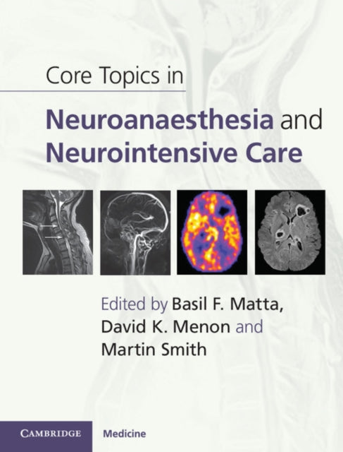 Book cover of: Core Topics in Neuroanaesthesia and Neurointensive Care. By: Basil F. Matta