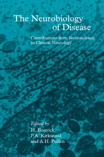Book cover of: Neurobiology of Disease
