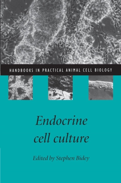 Book cover of: Endocrine Cell Culture