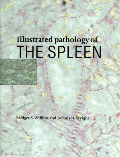 Book cover of: Illustrated Pathology of the Spleen. By: Bridget S. Wilkins