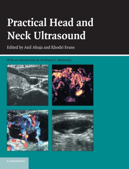 Book cover of: Practical Head and Neck Ultrasound