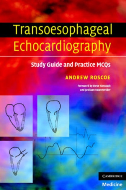 Book cover of: Transoesophageal Echocardiography. By: Andrew Roscoe
