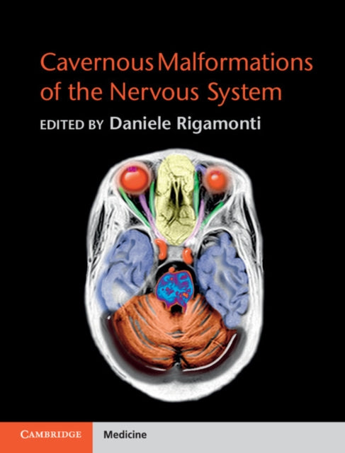 Book cover of: Cavernous Malformations of the Nervous System. By: Daniele Rigamonti