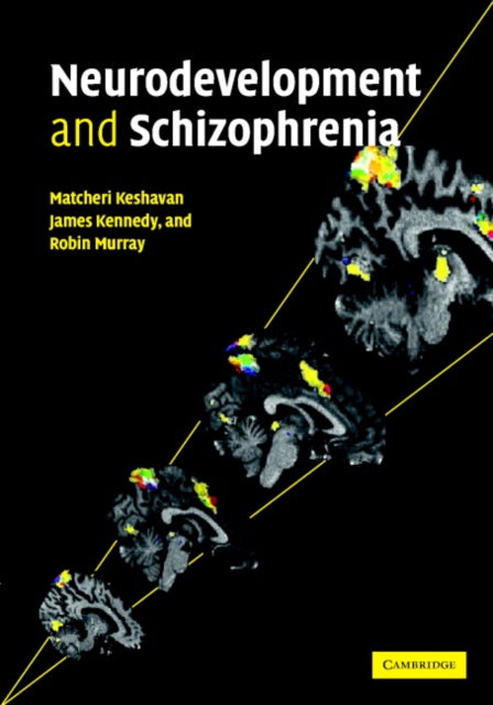 Book cover of: Neurodevelopment and Schizophrenia