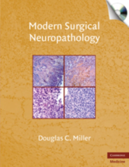 Book cover of: Modern Surgical Neuropathology with CD-ROM. By: Douglas C. Miller