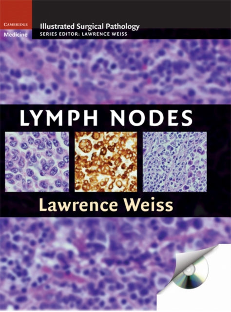 Book cover of: Lymph Nodes. By: Lawrence M. Weiss, Lawrence Weiss