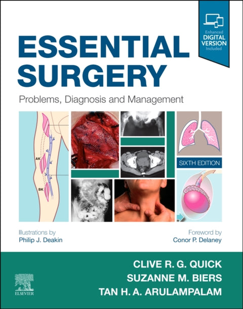 Essential Surgery