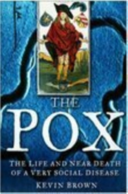Book cover of: Pox. By: Kevin Brown