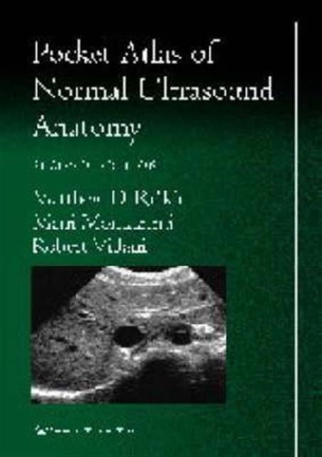 Book cover of: Pocket Atlas of Normal Ultrasound Anatomy. By: Matthew D. Rifkin