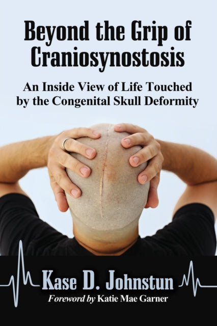 Book cover of: Beyond the Grip of Craniosynostosis. By: Kase D. Johnstun
