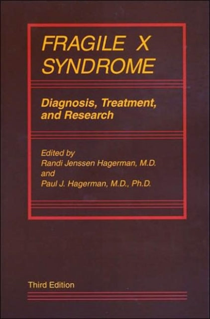 Book cover of: Fragile X Syndrome