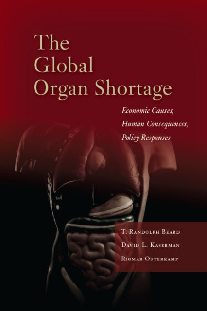 Book cover of: Global Organ Shortage. By: T. Randolph Beard