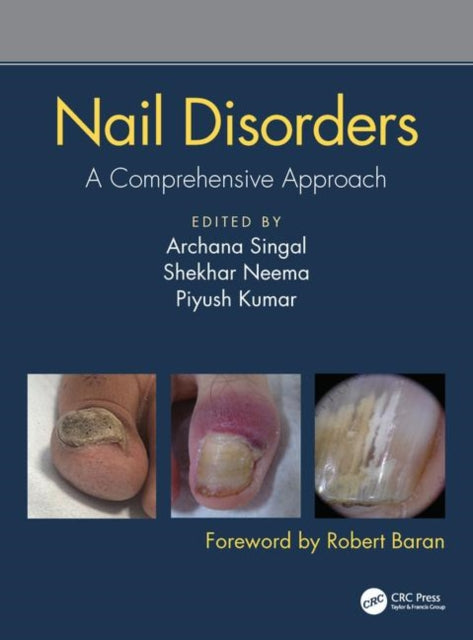 Book cover of: Nail Disorders
