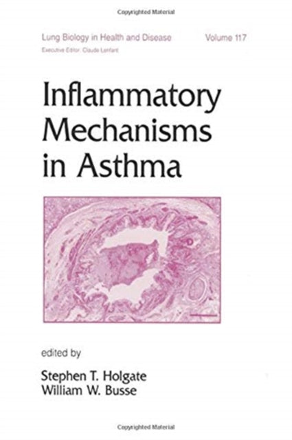 Book cover of: Inflammatory Mechanisms in Asthma. By: Stephen Holgate