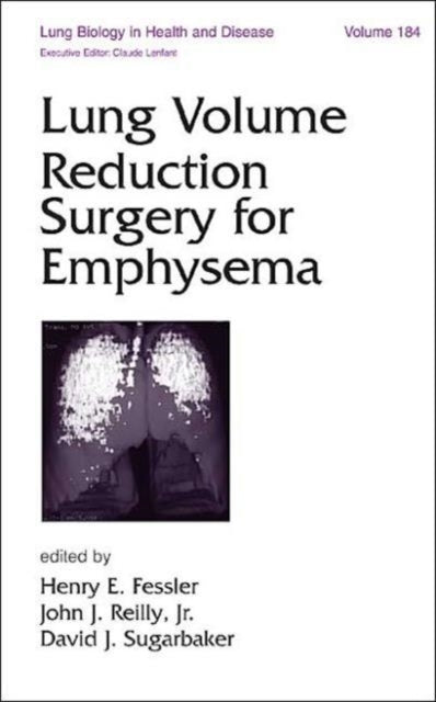 Book cover of: Lung Volume Reduction Surgery for Emphysema