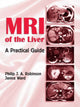 Book cover of: MRI of the Liver. By: Philip J.A. Robinson