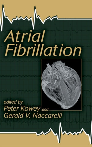 Atrial Fibrillation