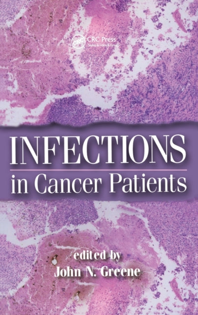 Book cover of: Infections in Cancer Patients. By: John N. Greene