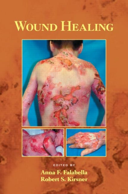 Book cover of: Wound Healing