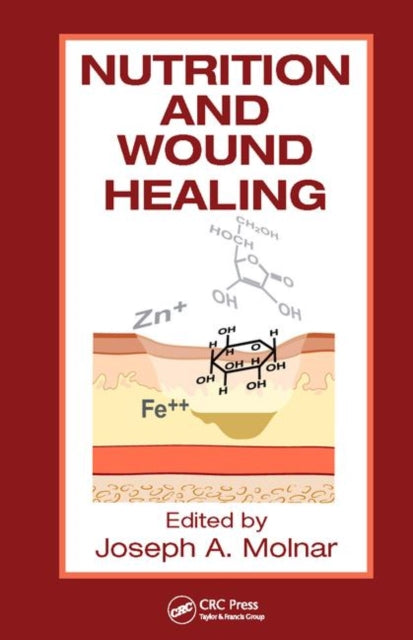 Book cover of: Nutrition and Wound Healing. By: MD,PhD,FACS, Joseph A. Molnar