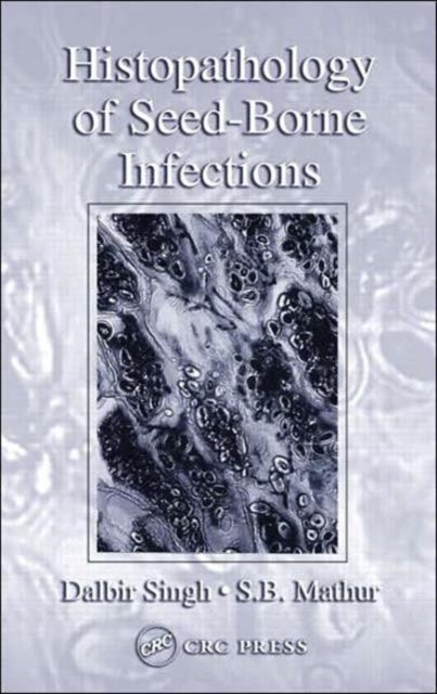 Book cover of: Histopathology of Seed-Borne Infections. By: Dalbir Singh.