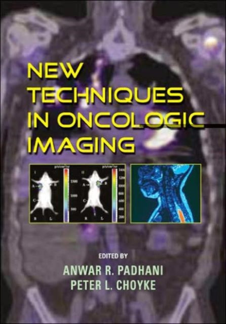 Book cover of: New Techniques in Oncologic Imaging