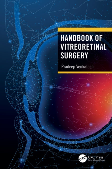Book cover of: Handbook of Vitreoretinal Surgery. By: Pradeep Venkatesh