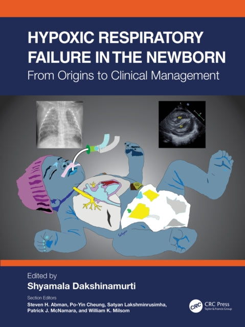 Book cover of: Hypoxic Respiratory Failure in the Newborn. By: Shyamala Dakshinamurti