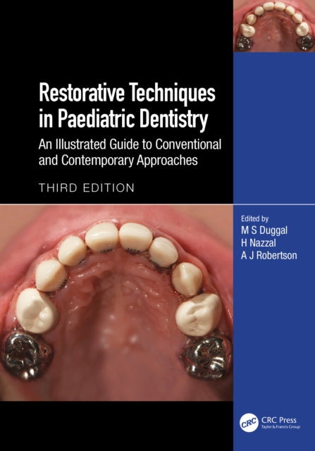 Book cover of: Restorative Techniques in Paediatric Dentistry