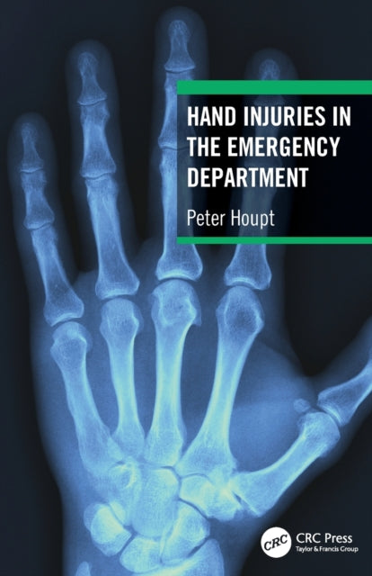 Book cover of: Hand Injuries in the Emergency Department. By: Peter Houpt