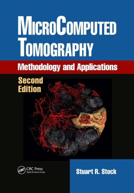 Book cover of: MicroComputed Tomography. By: Stuart R. Stock