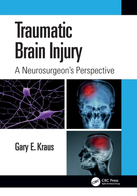 Book cover of: Traumatic Brain Injury: A Neurosurgeon's Perspective. By: Gary Kraus