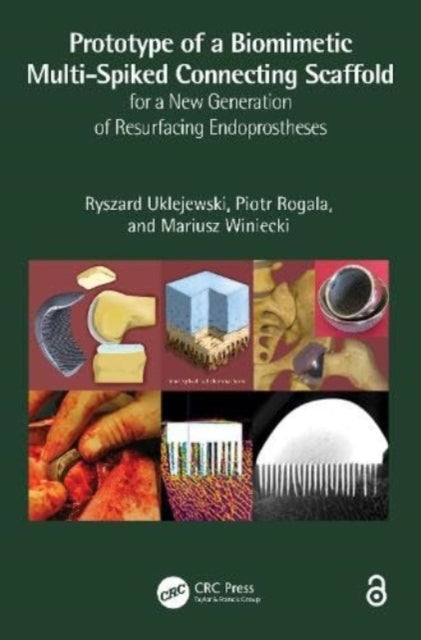 Book cover of: Prototype of a Biomimetic Multi-Spiked Connecting Scaffold for a New Generation of Resurfacing Endoprostheses. By: Ryszard Uklejewski