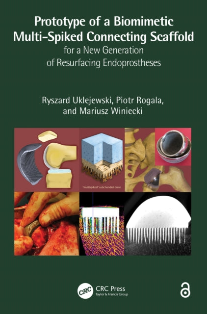 Book cover of: Prototype of a Biomimetic Multi-Spiked Connecting Scaffold for a New Generation of Resurfacing Endoprostheses. By: Ryszard Uklejewski
