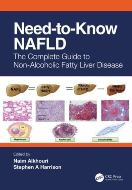 Need-to-Know NAFLD