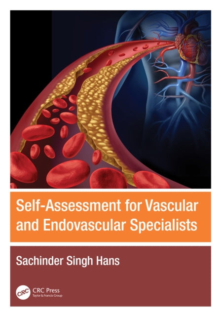 Book cover of: Self-Assessment for Vascular and Endovascular Specialists. By: S. S. Hans