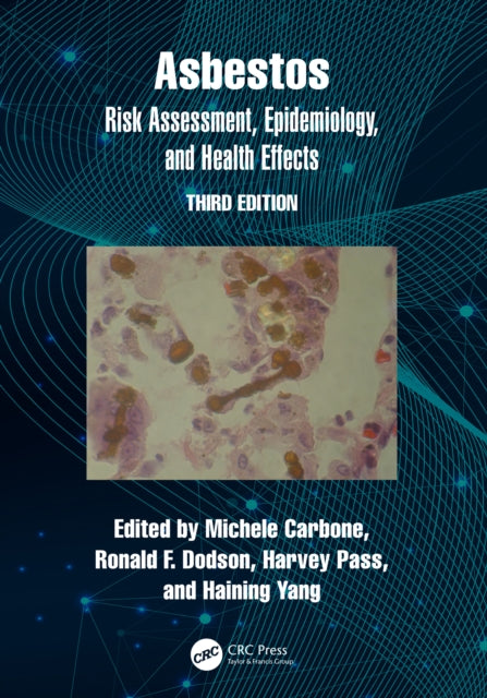 Book cover of: Asbestos. By: Michele Carbone
