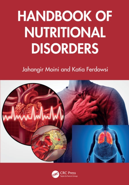 Book cover of: Handbook of Nutritional Disorders. By: Jahangir Moini