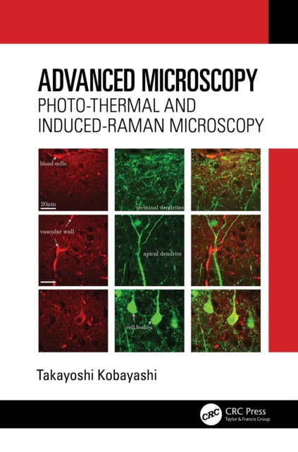 Book cover of: Advanced Microscopy. By: Takayoshi Kobayashi