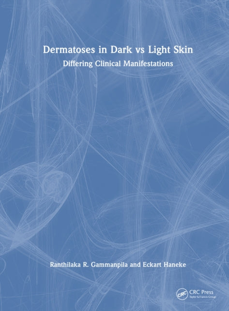Book cover of: Dermatoses in Dark Vs Light Skin